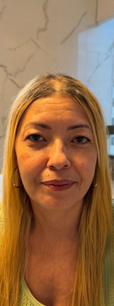 Antes — rejuvenescimento