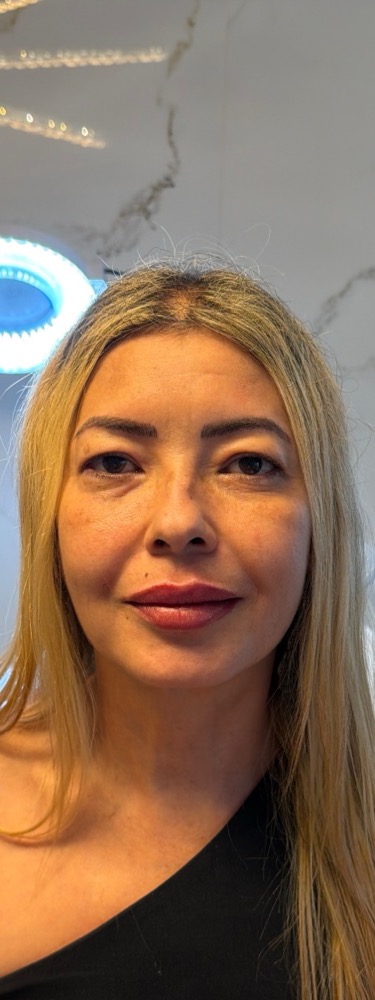 Depois — rejuvenescimento
